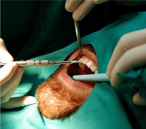 cheap dental care
