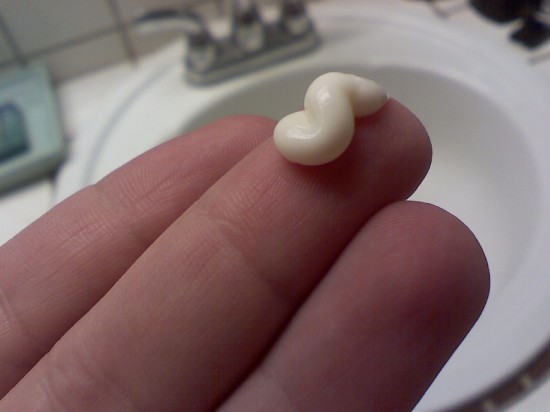 over the counter acne treatments may cause severe allergic reactions