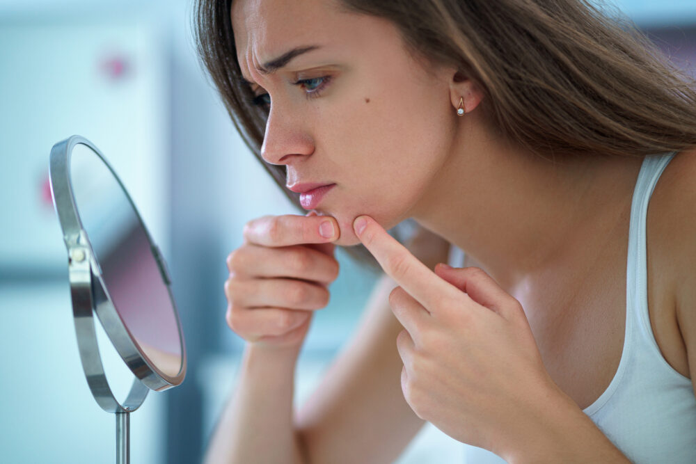 Woman looking at acne