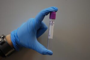 Syphilis Cases Lead STI Epidemic to New Highs